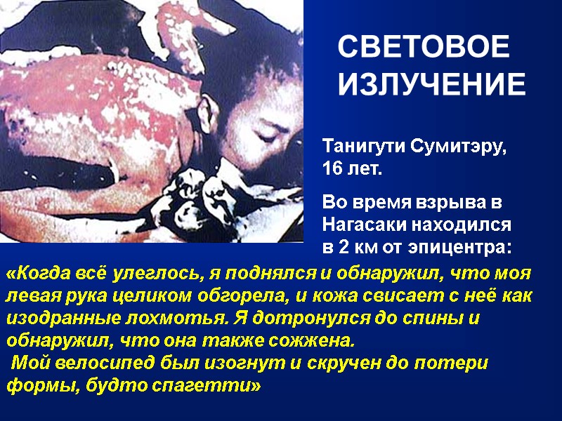 СВЕТОВОЕ ИЗЛУЧЕНИЕ Танигути Сумитэру,  16 лет.  Во время взрыва в Нагасаки находился